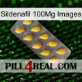 Sildenafil 100Mg Images cialis1